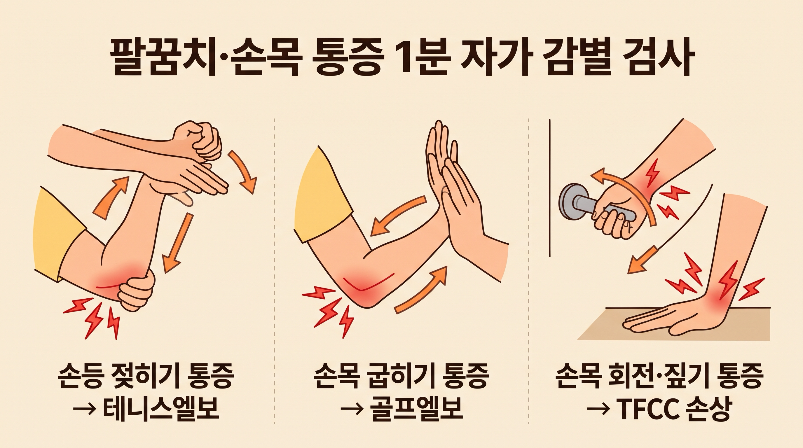 [그림 2] 통증 부위와 유발 동작으로 찾는 팔꿈치·손목 4대 질환 감별 지도